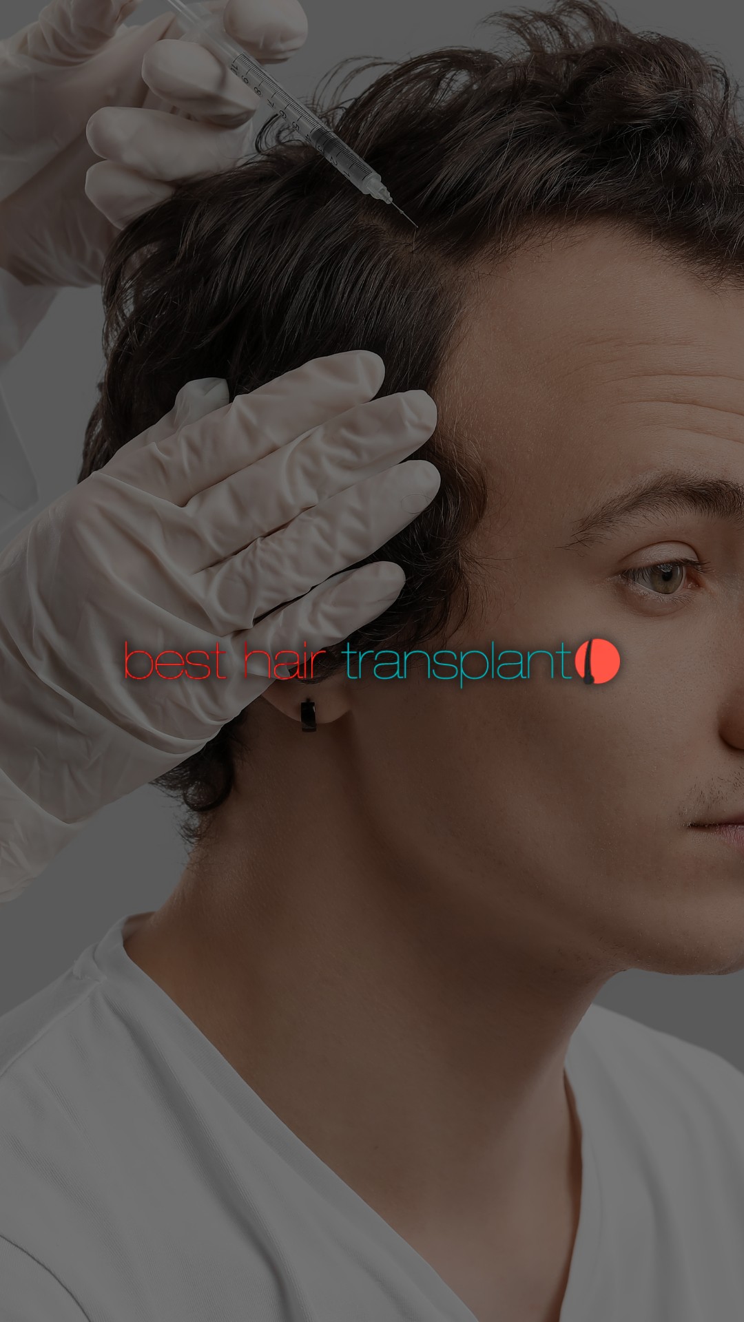 Best Hair Transplant